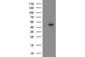 Western Blotting (WB) image for anti-Mitochondrial Methionyl-tRNA Formyltransferase (MTFMT) (AA 175-389) antibody (ABIN1491020) (MTFMT anticorps  (AA 175-389))