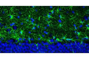 Representative section of formalin fixed, paraffin-embedded rat brain hippocampus region showing staining of GFAP. (GFAP anticorps  (AA 411-422))
