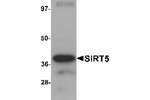 Western blot analysis of SIRT5 in human liver tissue lysate with SIRT5 antibody at 1 µg/mL. (SIRT5 anticorps  (C-Term))