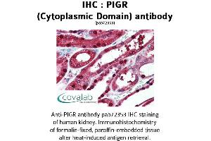 Image no. 1 for anti-Polymeric Immunoglobulin Receptor (PIGR) (Cytoplasmic Domain) antibody (ABIN1738096)