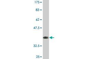 Western Blot detection against Immunogen (37.