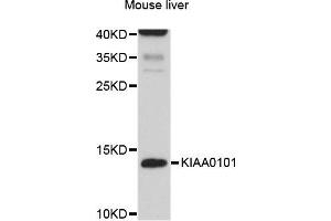Western blot analysis of extracts of Mouse liver cells, using KIAA0101 antibody. (KIAA0101 anticorps)