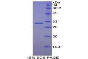 SDS-PAGE (SDS) image for Early B-Cell Factor 2 (EBF2) (AA 285-536) protein (His tag) (ABIN1879720)