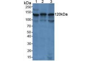 Figure. (PARP1 anticorps  (AA 661-881))