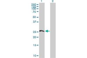 Western Blot analysis of PSMA8 expression in transfected 293T cell line by PSMA8 MaxPab polyclonal antibody. (PSMA8 anticorps  (AA 1-250))