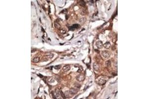 Image no. 2 for anti-HtrA Serine Peptidase 1 (HTRA1) (AA 389-419), (C-Term) antibody (ABIN356844) (HTRA1 anticorps  (C-Term))