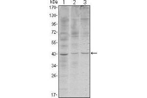 Western blot analysis using WIF1 mouse mAb against Hela (1), NIH/3T3 (2) and NTERA-2 (3) cell lysate. (WIF1 anticorps)