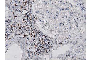 Immunohistochemical staining of paraffin-embedded Human Kidney tissue using anti-MSI1 mouse monoclonal antibody. (MSI1 anticorps)