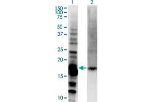 Western Blot analysis of DAZAP2 expression in transfected 293T cell line by DAZAP2 monoclonal antibody (M06), clone 8G5. (DAZAP2 anticorps  (AA 1-168))