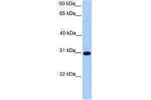 ETFB antibody used at 1 ug/ml to detect target protein. (ETFB anticorps  (C-Term))