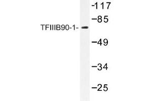 Image no. 1 for anti-BRF1, RNA polymerase III transcription initiation factor subunit (BRF1) antibody (ABIN317615) (BRF1 anticorps)