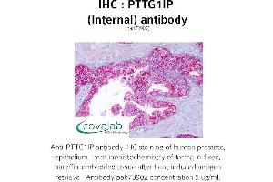 Image no. 1 for anti-Pituitary Tumor-Transforming 1 Interacting Protein (PTTG1IP) (Internal Region) antibody (ABIN1738624) (PTTG1IP anticorps  (Internal Region))