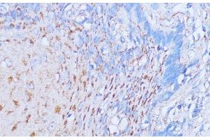 Immunohistochemistry of paraffin-embedded Human esophageal using NME6 Polyclonal Antibody at dilution of 1:100 (40x lens). (NME6 anticorps)