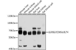 Western blot analysis of extracts of various cell lines, using LILRB2/CD85d/ILT4 antibody (ABIN6131861, ABIN6143217, ABIN6143219 and ABIN6214278) at 1:1000 dilution. (LILRB2 anticorps)