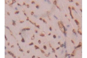 Detection of FABP4 in Mouse Heart Tissue using Polyclonal Antibody to Fatty Acid Binding Protein 4 (FABP4)