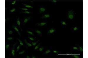 Immunofluorescence of monoclonal antibody to ZAK on HeLa cell.