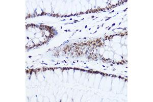 Immunohistochemistry of paraffin-embedded human colon using [KO Validated] Histone H1.