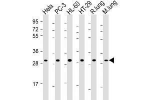 Western Blot at 1:2000 dilution Lane 1: Hela whole cell lysate Lane 2: PC-3 whole cell lysate Lane 3: HL-60 whole cell lysate Lane 4: HT-29 whole cell lysate Lane 5: rat lung lysate Lane 6: mouse lung lysate Lysates/proteins at 20 ug per lane. (RPS4X anticorps  (AA 209-243))
