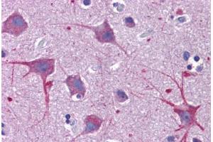 Human Brain, Cortex: Formalin-Fixed, Paraffin-Embedded (FFPE) (SKA1 anticorps  (C-Term))