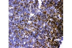 IHC-P: MCAK antibody testing of rat thymus tissue (KIF2C anticorps  (AA 531-725))
