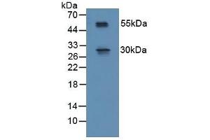 Detection of RSPO1 in Mouse Spinal Cord Tissue using Polyclonal Antibody to R-Spondin 1 (RSPO1) (RSPO1 anticorps  (AA 21-135))