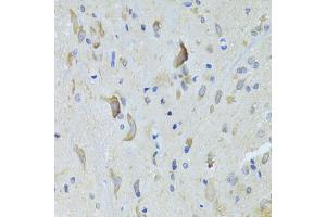 Immunohistochemistry of paraffin-embedded rat spinal cord using SARS Antibody (ABIN5974071) at dilution of 1/100 (40x lens). (Seryl-tRNA Synthetase (SARS) anticorps)