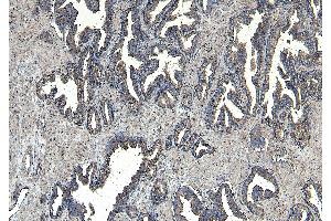 ABIN334371 (8µg/ml) staining of paraffin embedded Human Prostate.