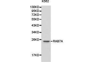 Western Blotting (WB) image for anti-RAB7A, Member RAS Oncogene Family (RAB7A) antibody (ABIN1874518) (RAB7A anticorps)