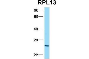 Host:  Rabbit  Target Name:  RPL13  Sample Type:  Hela  Antibody Dilution:  1.