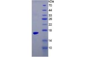 SDS-PAGE of Protein Standard from the Kit (Highly purified E.