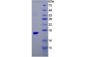 SDS-PAGE of Protein Standard from the Kit (Highly purified E. (TTR Kit ELISA)