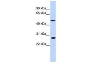 Image no. 1 for anti-Zinc Finger Protein 556 (ZNF556) (AA 36-85) antibody (ABIN6740460) (ZNF556 anticorps  (AA 36-85))