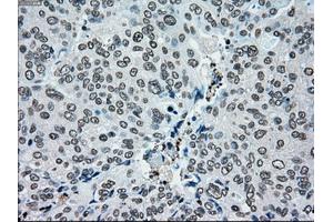 Image no. 3 for anti-Premelanosome Protein (PMEL) antibody (ABIN1500300)