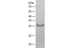 Western Blotting (WB) image for Heterogeneous Nuclear Ribonucleoprotein A/B (HNRNPAB) (AA 1-285) protein (His tag) (ABIN7123317)