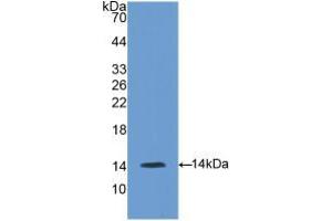 Western blot analysis of recombinant Mouse GnRH. (GNRH1 anticorps  (AA 22-90))