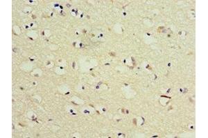 Immunohistochemistry of paraffin-embedded human brain tissue using ABIN7173541 at dilution of 1:100 (TSEN2 anticorps  (AA 1-220))