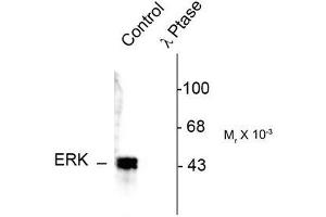 Image no. 1 for anti-Mitogen-Activated Protein Kinase 3 (MAPK3) (pThr202), (Tyr204) antibody (ABIN372623) (ERK1 anticorps  (pThr202, Tyr204))
