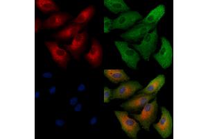 ABIN6260420 and ABIN6279238 staining  cells by IF/ICC.