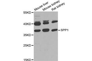 Western blot analysis of extracts of various cell lines, using SPP1 antibody (ABIN1874927) at 1:1000 dilution. (Osteopontin anticorps)
