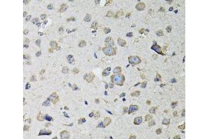 Immunohistochemistry of paraffin-embedded Mouse brain using RASSF1 Polyclonal Antibody at dilution of 1:100 (40x lens). (RASSF1 anticorps)
