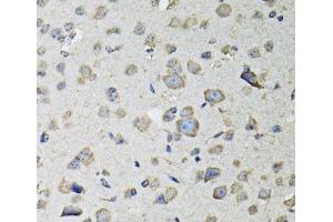 Immunohistochemistry of paraffin-embedded Mouse brain using RASSF1 Polyclonal Antibody at dilution of 1:100 (40x lens).