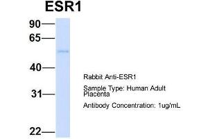 Host: Rabbit  Target Name: ESR1  Sample Tissue: Human Adult Placenta  Antibody Dilution: 1. (Estrogen Receptor alpha anticorps  (C-Term))