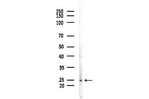 anti-ADP-Ribosylation Factor-Like 5B (ARL5B) (Internal Region) antibody