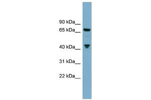 WB Suggested Anti-GLS  Antibody Titration: 0.