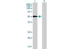 Western Blot analysis of MEIS2 expression in transfected 293T cell line by MEIS2 monoclonal antibody (M01), clone 1H4. (MEIS2 anticorps  (AA 1-381))