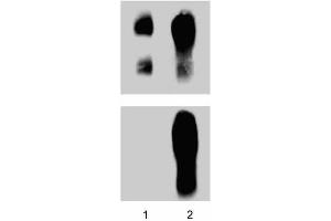anti-Catenin (Cadherin-Associated Protein), delta 1 (CTNND1) (pTyr228) antibody