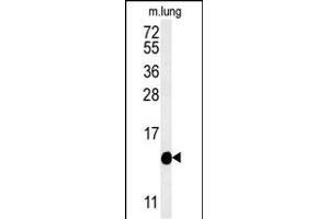 Western blot analysis of IFT20 Antibody (Center)  in mouse lung tissue lysates (35 μg/lane). (IFT20 anticorps  (Center))