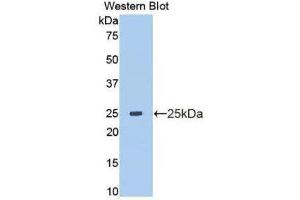 Western Blotting (WB) image for anti-Matrix Metallopeptidase 13 (Collagenase 3) (MMP13) (AA 103-290) antibody (ABIN1172282) (MMP13 anticorps  (AA 103-290))