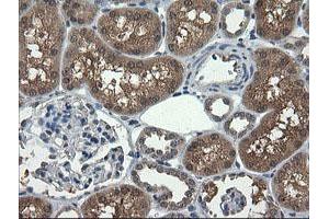 Image no. 4 for anti-Ubiquitin-Conjugating Enzyme E2G 2 (UBE2G2) antibody (ABIN1501631)