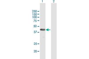 Western Blot analysis of FAM62B expression in transfected 293T cell line by FAM62B MaxPab polyclonal antibody. (FAM62B anticorps  (AA 1-358))